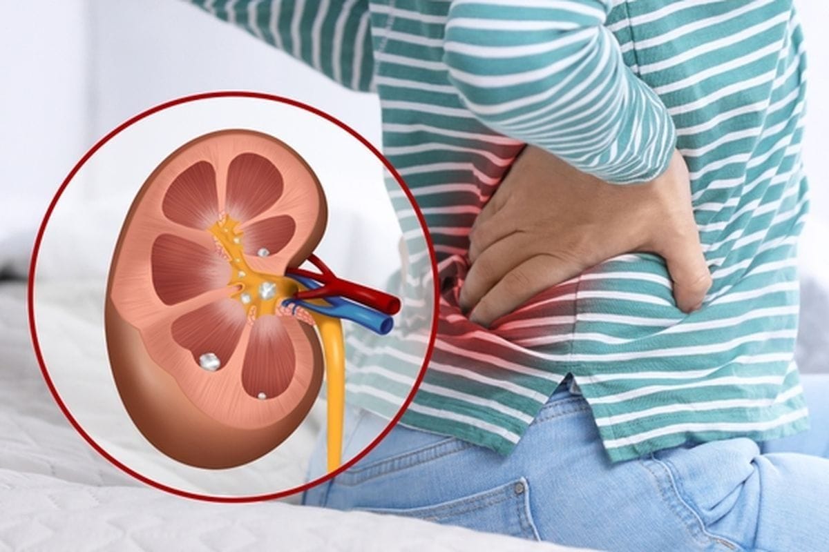 Alasan Kaki Sering Kram Bisa Menjadi Tanda Gagal Ginjal